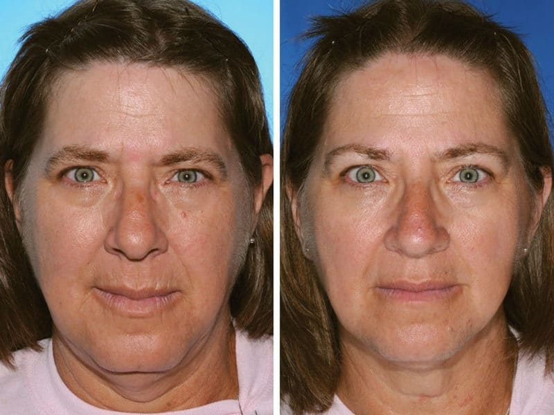This Is What 7 Smoker vs. Non-Smoker Identical Twins Look Like After Years Of Lighting Up
