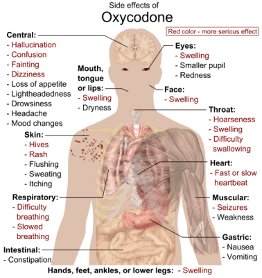 567px-Side_effects_of_Oxycodone