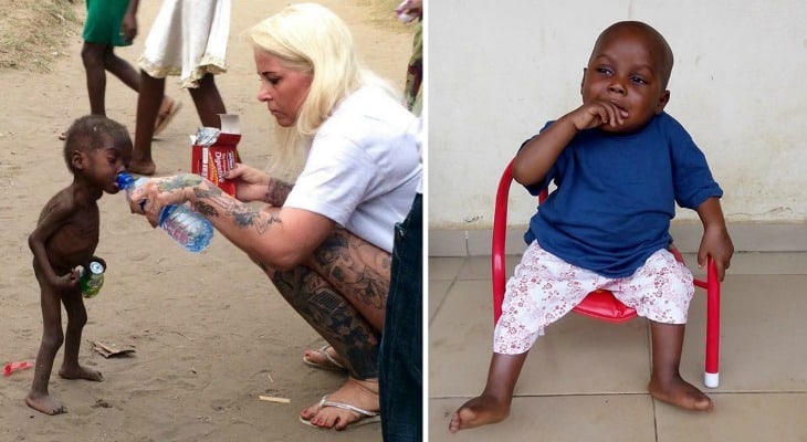 2-Year-Old ‘Witch Child’ Left To Die Makes Remarkable Recovery [Photos]