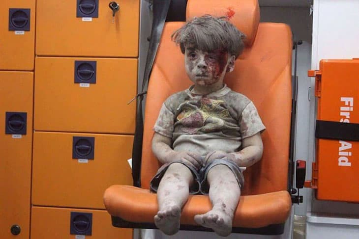 Gut-Wrenching Photo Of Dazed 5-Year-Old Reveals The Horrors Of The Syria Conflict