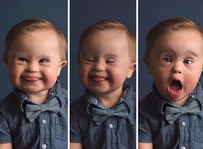 Mom Fights Back After Son Gets Rejected From Ad Campaign “Because He Has Down’s Syndrome”