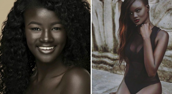 Teen Bullied For Dark Skin Becomes A Model, Stuns And Inspires The Internet