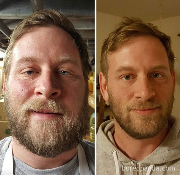 20+ Before & After Photos That Reveal The Effects Of Giving Up Alcohol