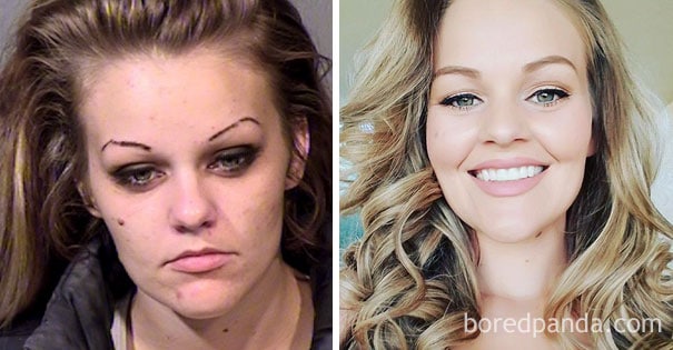 These 20+ Before & After Photos Reveal The Effects Of Giving Up Drugs