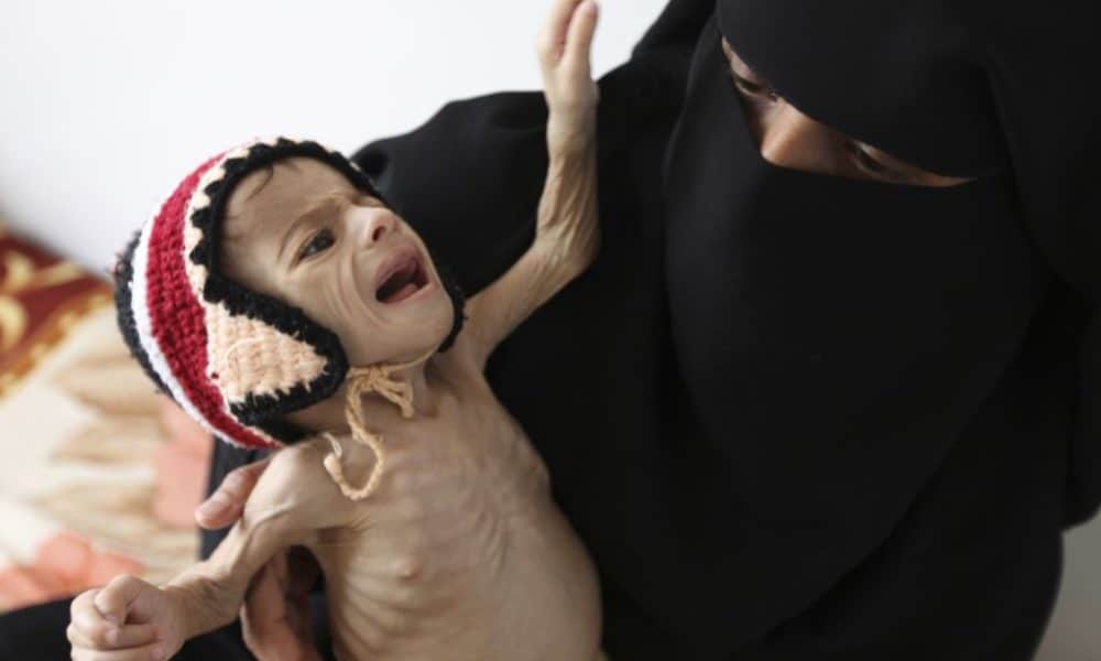 A Thousand Children Die Every Week As a Result of the US-Saudi War in Yemen