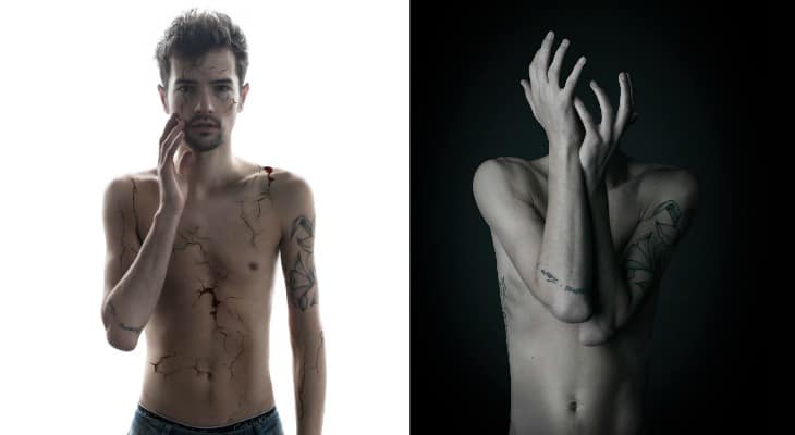 Emotional Photo Series Highlights The Insecurities Most People Suffer From