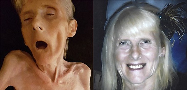 Family Release Pictures Of MS-Suffering Mother In Her Final Days Of ‘Torture’