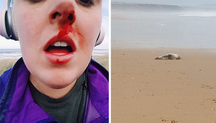 Activist Gets Punched In The Face After Confronting Teens Who Were Torturing A Seal