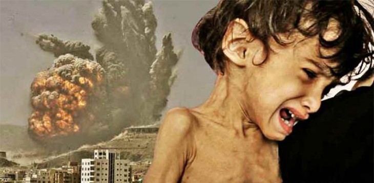 Americans Ignorant That U.S. Is Aiding A Genocide By Mass Starvation In Yemen