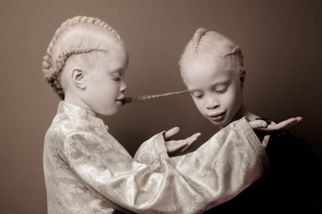 These Albino Twins Have Captivated The World With Their Unconventional Beauty