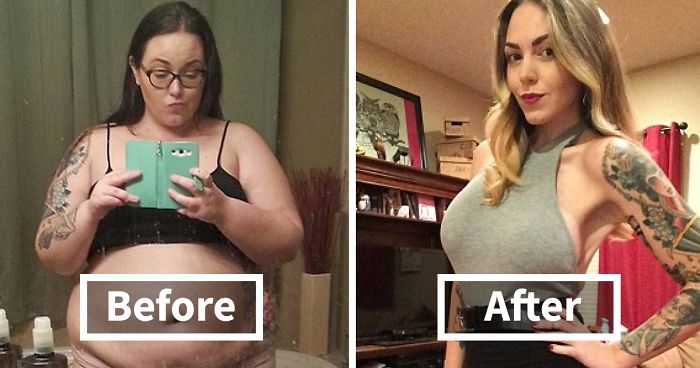 These 15+ “Before And After” Weight Loss Photos Will Inspire You To Never Give Up