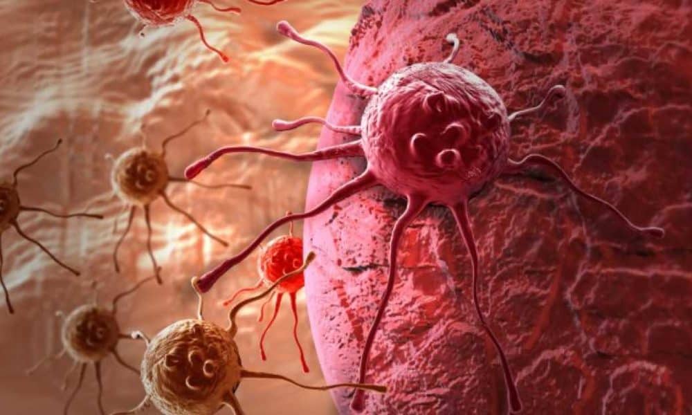 Groundbreaking Breast Cancer Trial Destroys Tumors In Just 11 Days