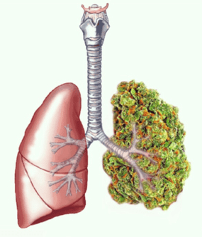 https://www.google.cl/imgres?imgurl=http%3A%2F%2Fdata.whicdn.com%2Fimages%2F90477732%2Flarge.jpg&imgrefurl=http%3A%2F%2Fherb.co%2F2015%2F09%2F07%2Fhow-to-smoke-weed-and-keep-your-lungs-healthy%2F&docid=IA7hjMot2yDRjM&tbnid=4Rxsi3LwO4_F6M%3A&vet=10ahUKEwjUhoStv4HVAhWBE5AKHZYKB5UQMwiaASgYMBg..i&w=500&h=500&bih=568&biw=1170&q=lungs%20cannabis&ved=0ahUKEwjUhoStv4HVAhWBE5AKHZYKB5UQMwiaASgYMBg&iact=mrc&uact=8