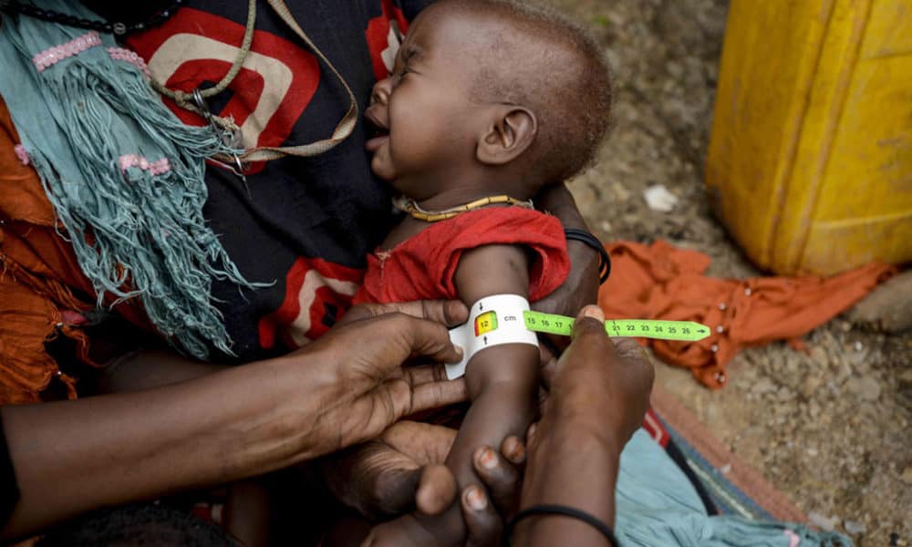 Largest Humanitarian Crisis Of The Century: Famine Spreads Across Africa