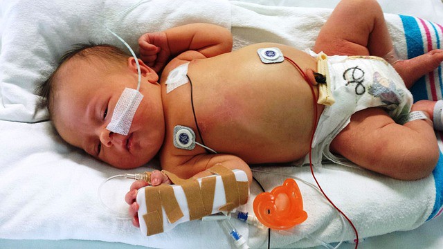 https://pixabay.com/en/newborn-sick-baby-medical-health-617414/