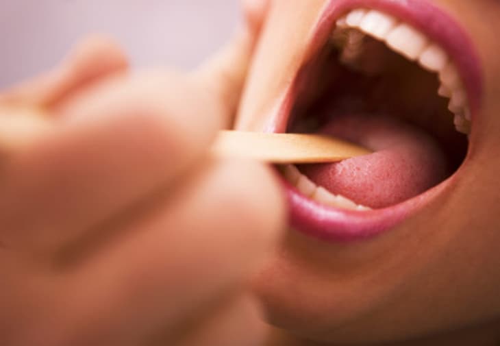 16 Signs and Symptoms of Strep Throat