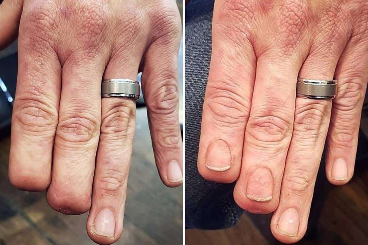 Tattoo Artist Designs Hyper-Realistic Fingernails On An Amputee And You Wouldn’t Even Notice That It Was A Work Of Art!