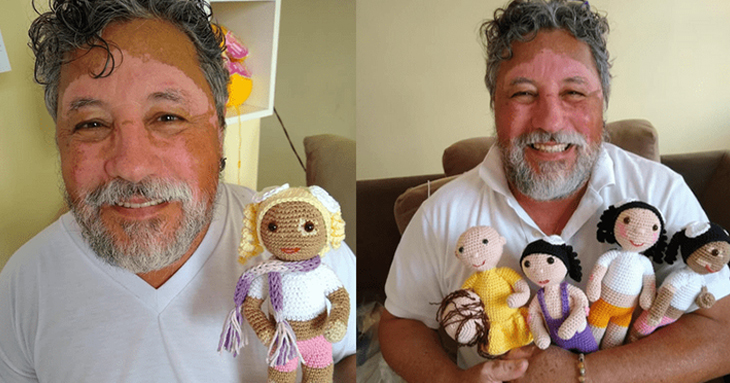 A Brazilian Grandad With Vitiligo Crochets Special Dolls For Kids To Experience Inclusion