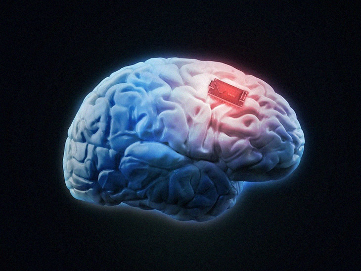 Scientists Have Successfully Designed A Brain Implant That Fights Off Depression