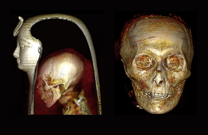 Scientists Manage To Digitally ‘Unwrap’ Perfectly Preserved Royal Mummy Without Ever Opening It